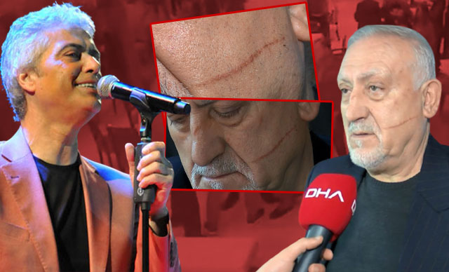 Cengiz Kurtoğlu'nun saldırdığı Mustafa Can konuştu 