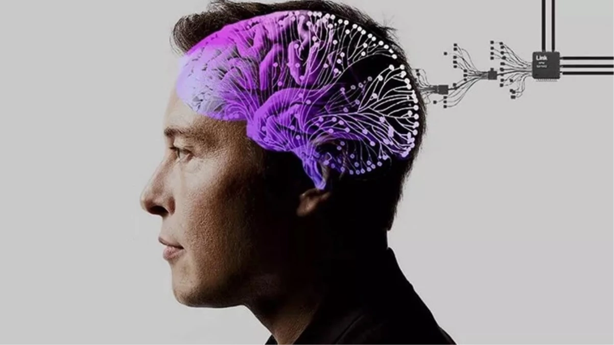 Elon Musk, beyin çipiyle bilgisayar faresinin kontrol edilebildiğini açıkladı - TEKNOLOJİ - Ulusal ve Yerel Medyanın Gücü